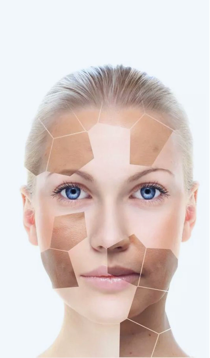 Nihels Skintech ND YAG Laser Nihels Skintech ND YAG Laser