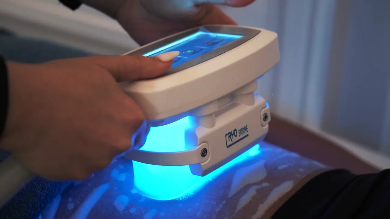 Applicateur de cryolipolyse posé sur l'abdomen pendant une séance au centre